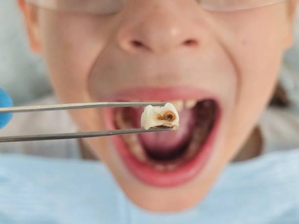 Best Emergency Denture Repair in Mans, CO