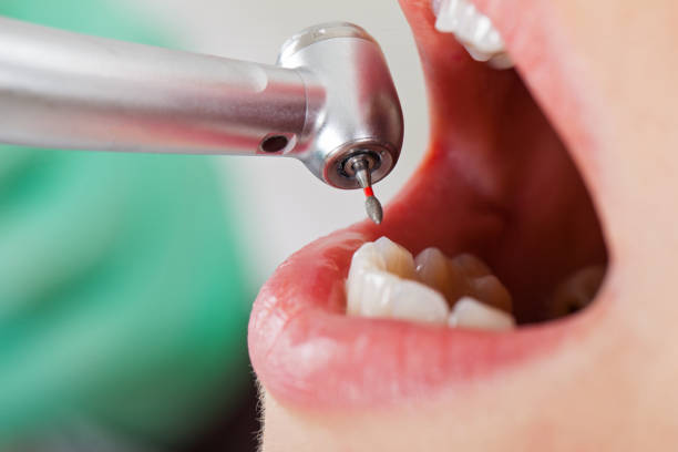 Best Emergency Gum Treatment in Mans, CO